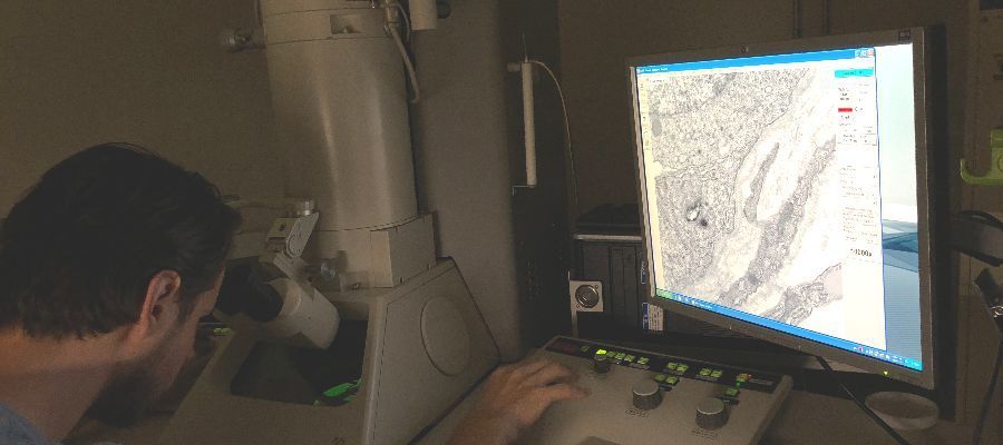 Transmission electron microscope observation
