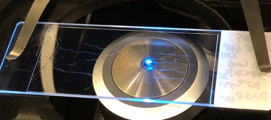 Super-resolution microscope observation